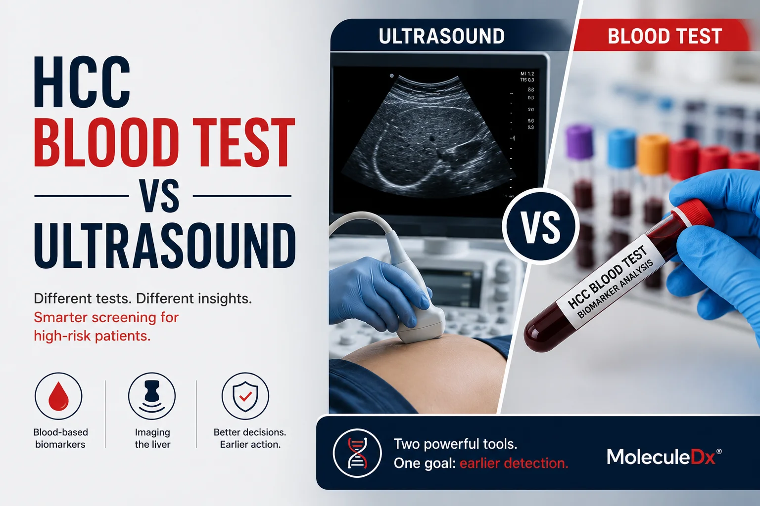 HCC blood test vs ultrasound — liver cancer screening comparison MoleculeDx Fusion-detect